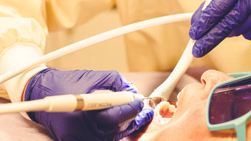 Close up of hygienist cleaning teeth